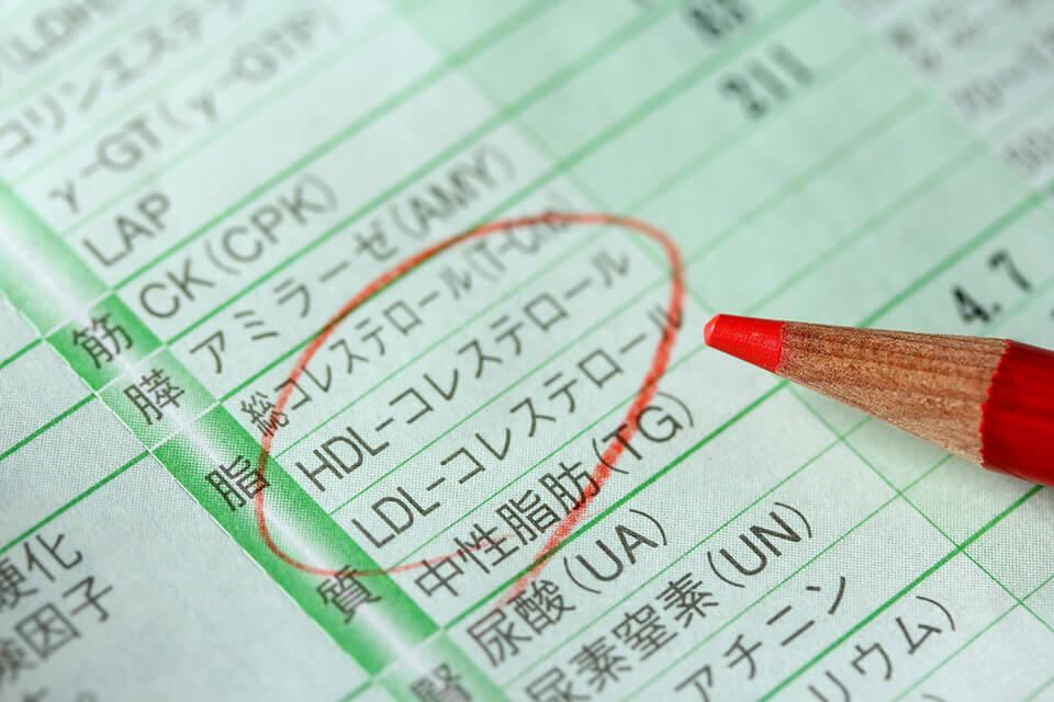 コーヒーを飲むことの利点